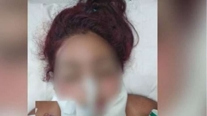 Νέες ανατριχιαστικές λεπτομέρειες για τον βιασμό της κοπέλας στο Ζεφύρι - Ξύπνησε από το κώμα