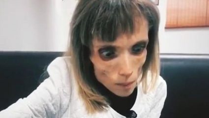 Αδιανόητη ατάκα γιατρού σε ανορεξική: «Μπορείς να παίξεις το ζόμπι» Αδιανόητη ατάκα γιατρού σε ανορεξική: «Μπορείς να παίξεις το ζόμπι»