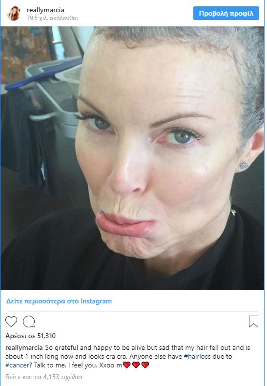 Η μάχη της διάσημης ηθοποιού με τον καρκίνο - Ανέβασε φωτογραφία στο instagram ζητώντας συμπαράσταση