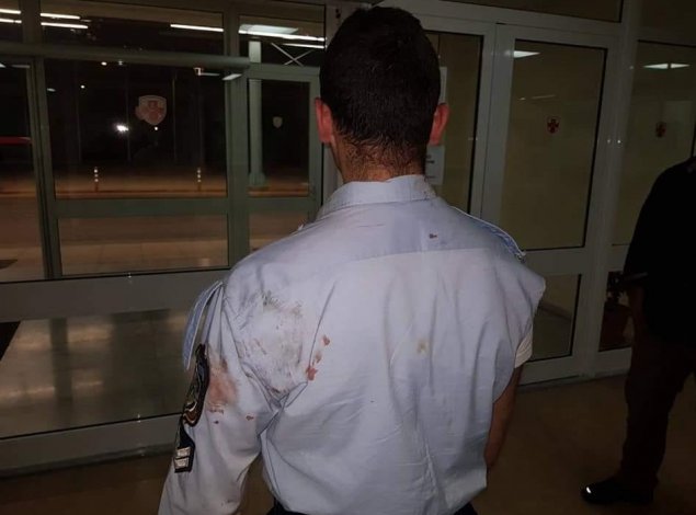 Εικόνες-σοκ: Τα τραύματα των αστυνομικών από την επίθεση των Ρομά στου Ρέντη (ΦΩΤΟ)