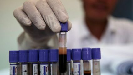 Tεστ αίματος ανιχνεύει οποιονδήποτε καρκίνο μέσα σε δέκα λεπτά Tεστ αίματος ανιχνεύει οποιονδήποτε καρκίνο μέσα σε δέκα λεπτά