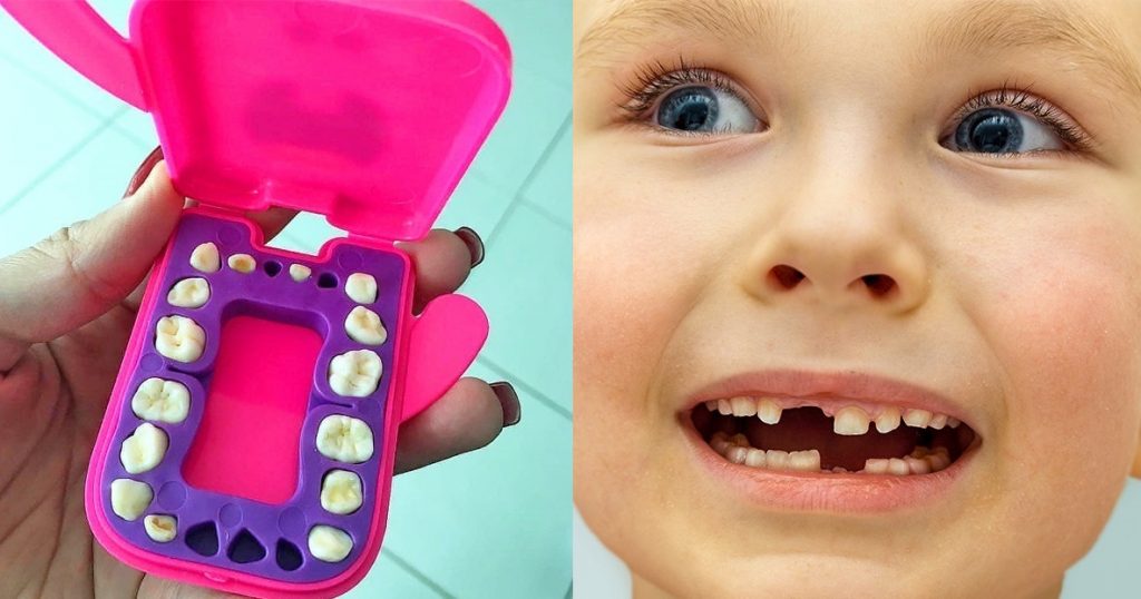 Γιατί οι γιατροί προτρέπουν τους γονείς να κρατούν τα πρώτα δόντια των παιδιών τους