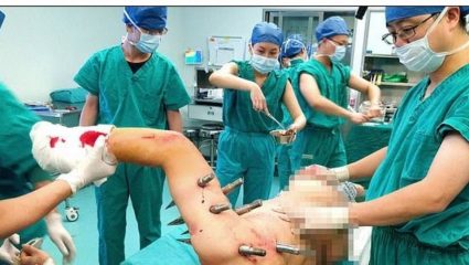 Ο «Εξολοθρευτής» τελικά… υπάρχει: Ρομπότ τραυμάτισε με μεγάλα καρφιά εργάτη εργοστασίου – (ΦΩΤΟ + ΒΙΝΤΕΟ) Ο «Εξολοθρευτής» τελικά… υπάρχει: Ρομπότ τραυμάτισε με μεγάλα καρφιά εργάτη εργοστασίου – (ΦΩΤΟ + ΒΙΝΤΕΟ)