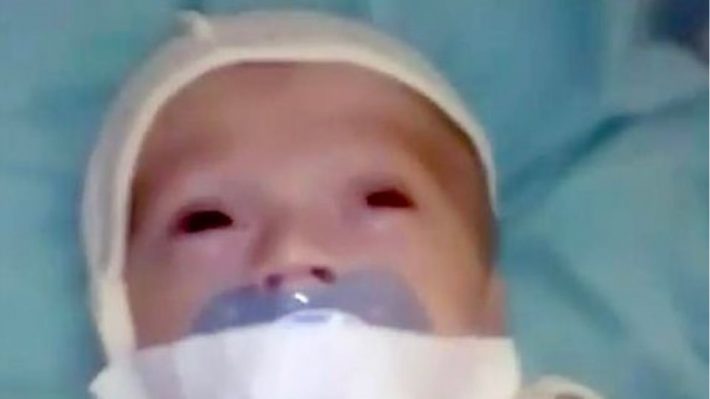 Σοκαριστικό βίντεο: Κόλλησαν με μονωτική ταινία την πιπίλα στο στόμα νεογέννητου σε νοσοκομείο!