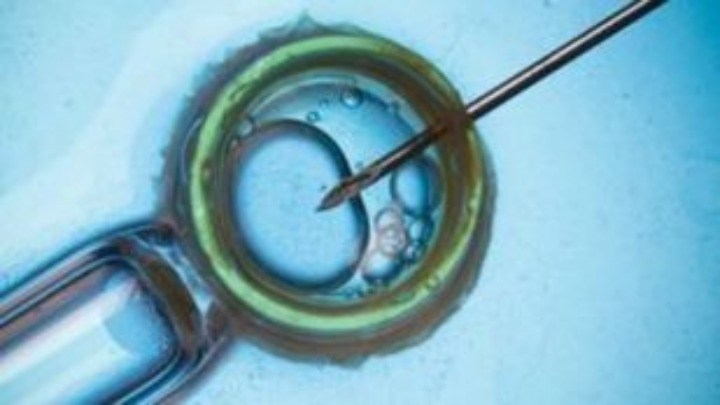 Νέα έρευνα αποκαλύπτει: Το σπέρμα μπορεί να φταίει για τις επαναλαμβανόμενες αποβολές μιας γυναίκας