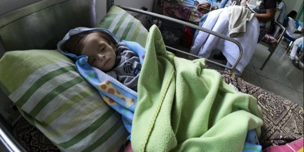 Σοκάρει η εικόνα αποστεωμένου παιδιού σε νοσοκομείο της Βενεζουέλας (ΦΩΤΟ)