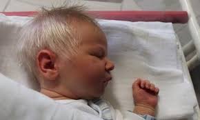 Σοκαριστικό φαινόμενο: Μωρό γεννήθηκε χωρίς δέρμα! (ΦΩΤΟ)