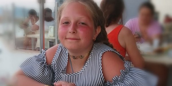 Νεκρή 12χρονη σε πισίνα ξενοδοχείου: Τη ρούφηξε η αντλία νερού