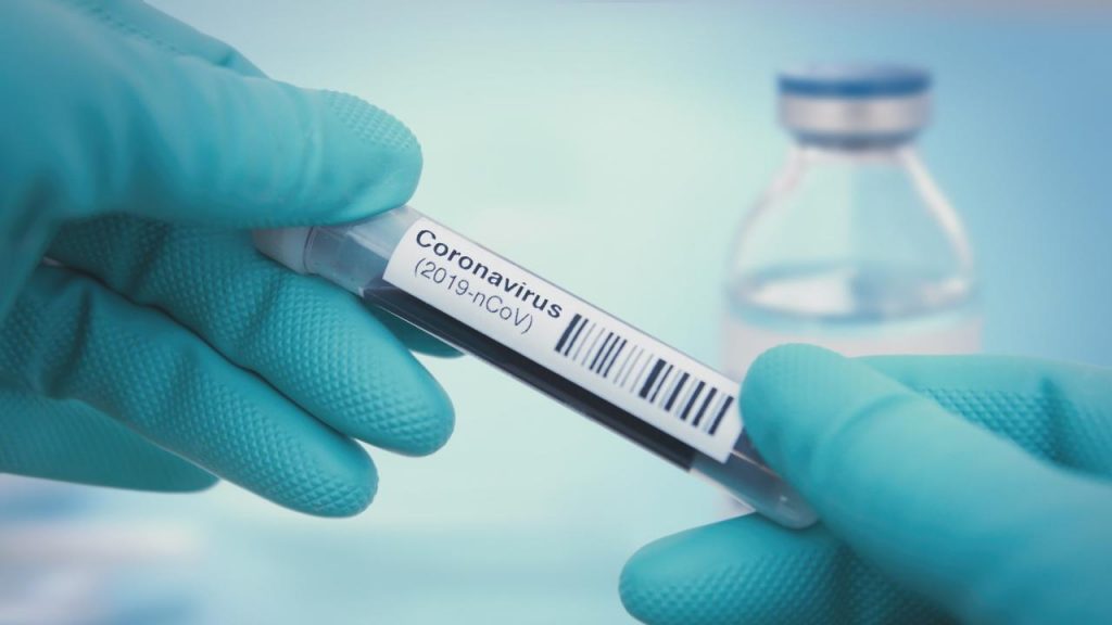 Τι θα γίνει αν βρεθεί το εμβόλιο του κορωνοϊού - Ποιος θα το πάρει πρώτος