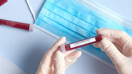 Ξεχάστε τα δωρεάν τεστ: «Τσιμπημένες» οι τιμές για rapid και pcr τεστ Ξεχάστε τα δωρεάν τεστ: «Τσιμπημένες» οι τιμές για rapid και pcr τεστ