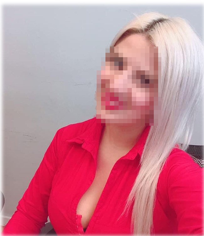 Επίθεση με βιτριόλι: Στη δημοσιότητα νέες φωτογραφίες της 35χρονης φερόμενης ως δράστις (Pics)