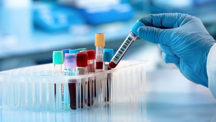 Αυτός είναι ο πρώτος ασθενής παγκοσμίως που θεραπεύτηκε από τον ιό με φάρμακα Αυτός είναι ο πρώτος ασθενής παγκοσμίως που θεραπεύτηκε από τον ιό με φάρμακα