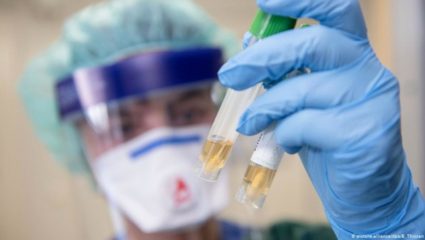 Πανεπιστήμιο Οξφόρδης: Το φυσικό προϊόν που χτυπάει τον ιό περισσότερο απ’ τα φάρμακα Πανεπιστήμιο Οξφόρδης: Το φυσικό προϊόν που χτυπάει τον ιό περισσότερο απ’ τα φάρμακα