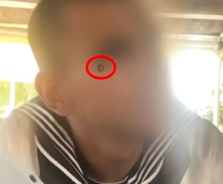 Μίλαγε από μόνο του: Τι συμβολίζει στη γλώσσα του υποκόσμου το τατουάζ του 20χρονου δράστη της δολοφονίας στον Άγιο Δημήτριο